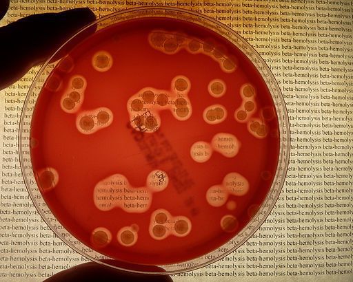Вокруг колонии бактерий практически прозрачный кровяной агар