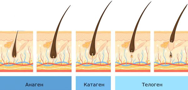 Андрогенное выпадение волос у женщин симптомы thumbnail