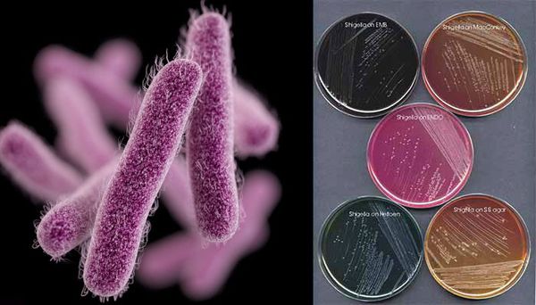 Бактерии Шигелла