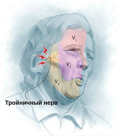 Гальванический синдром в полости рта диагностика лечение thumbnail