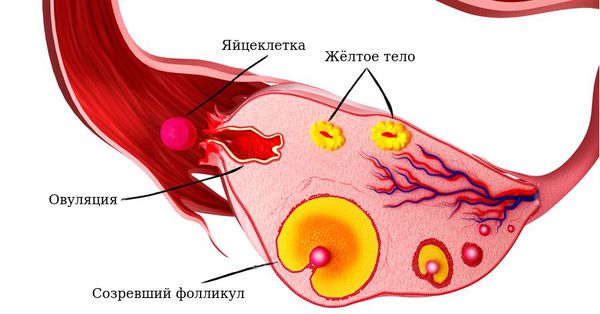 Ретенционное образование правого яичника киста желтого тела thumbnail