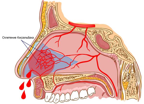 Кровотечение и отек носа thumbnail