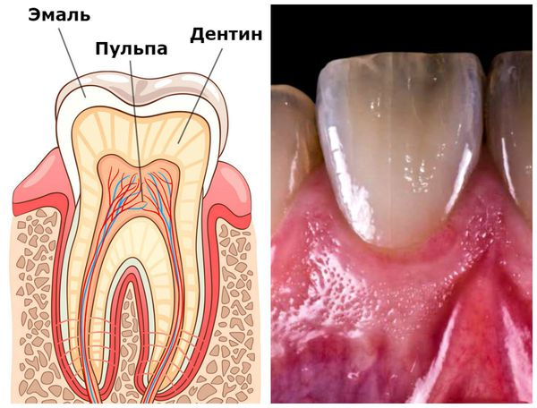 Эмаль, дентин, пульпа и естественный оттенок зуба