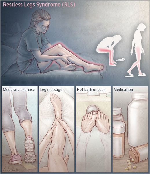 Синдром беспокойных ног причины и лечение малышева thumbnail