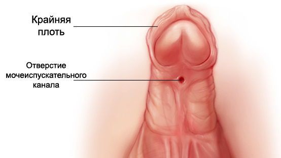 Синдром при котором у женщин обнаруживают два тельца барра thumbnail