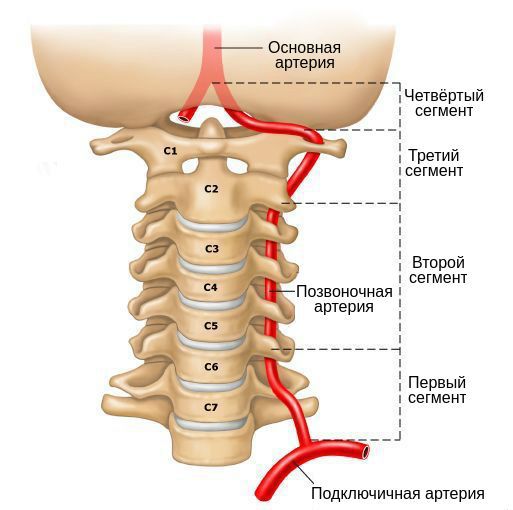 Синдром раздражения позвоночной артерии лечение thumbnail