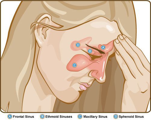 Головная боль и распирание в области пазух носа