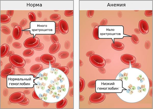 Кровь в норме и при анемии