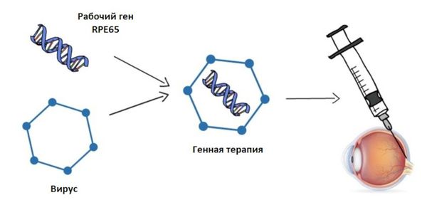 Лукстурна