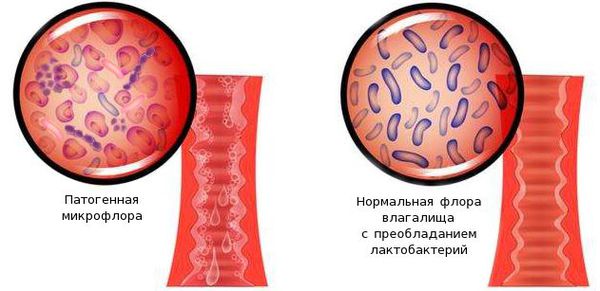 Бартолиновая железа фото где