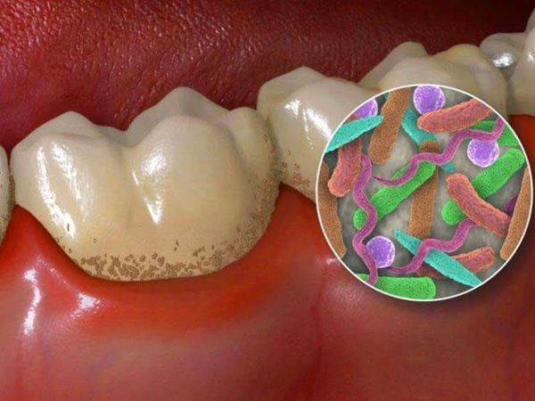 Бактерии полости рта