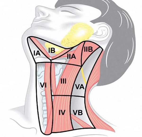 Уровни лимфатических узлов шеи