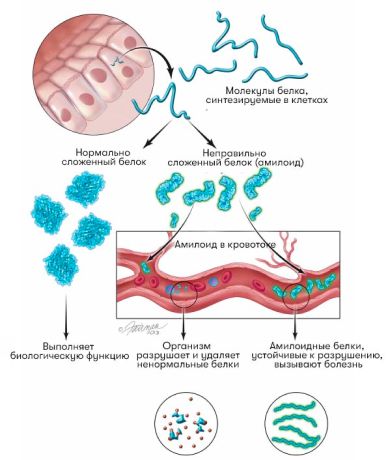 Нормальный белок и амилоид