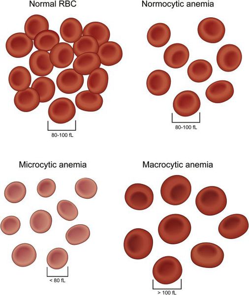 klassifikaciya anemiy po morfologii eritrocitov s