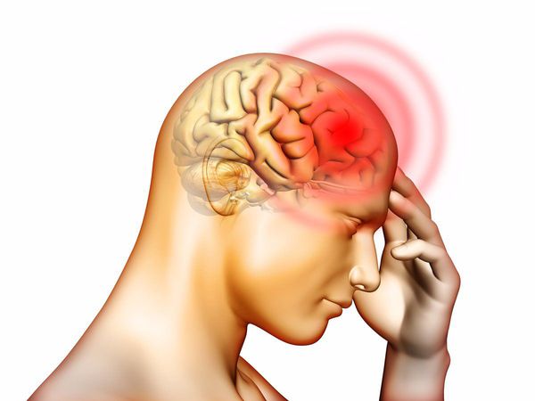 Причины сужения сосудов головного мозга