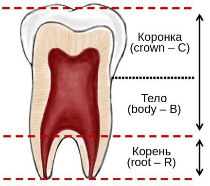Тауродонтизм: соотношение коронки и тела аномального зуба к его корню