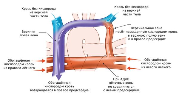 Кровообращение при АДЛВ