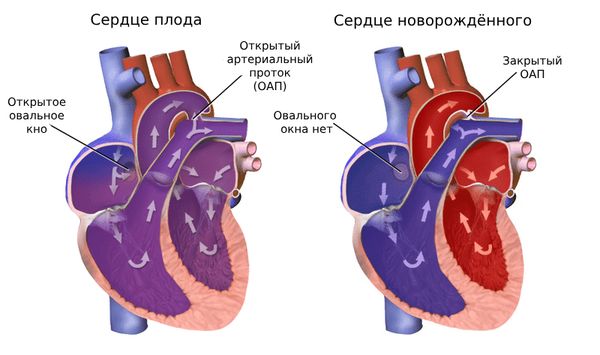 Сердце плода и новорождённого