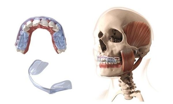 Сплинт-терапия
