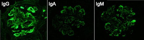 Иммунофлуоресцентный анализ [20]