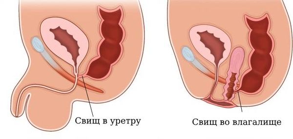 Жалаңаш Елена Старостинаның суреті