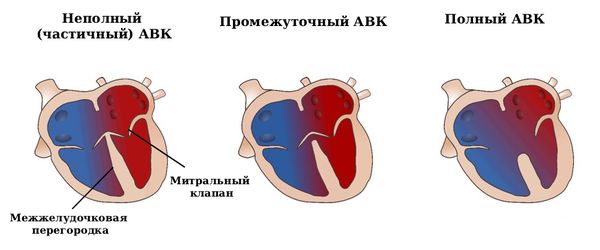 Формы АВК