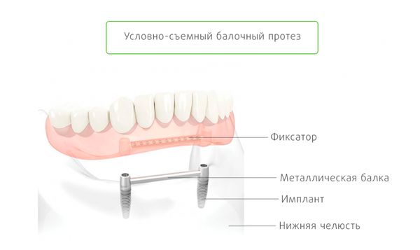 Балочная конструкция