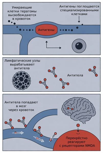 Патогенез анти-NMDA-рецепторного энцефалита