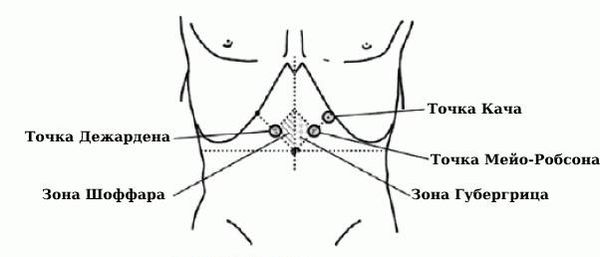 Зоны болезненности при пальпации Зоны болезненности при пальпации