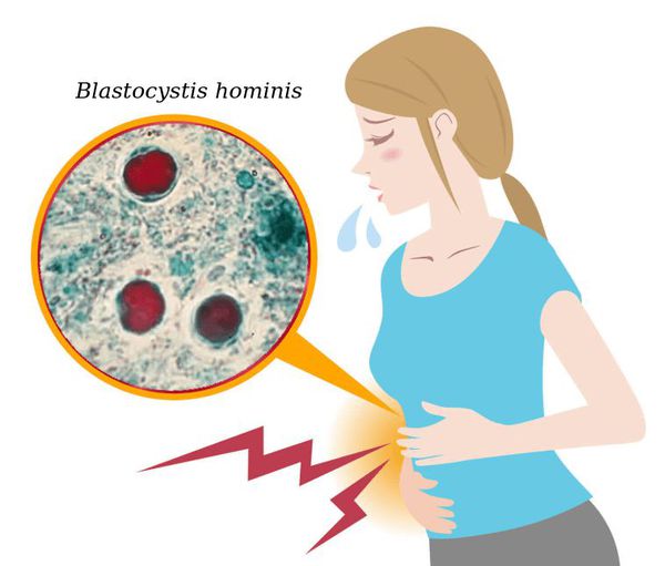 Микроорганизм Blastocystis в желудочно-кишечном тракте