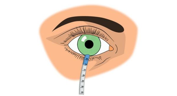 Тест Ширмера Тест Ширмера