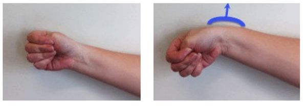 Тест Эйхофа [19]