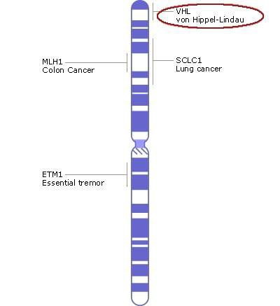 Хромосома 3,  ген VHL
