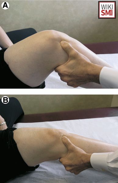 Тест Гоффа [12]