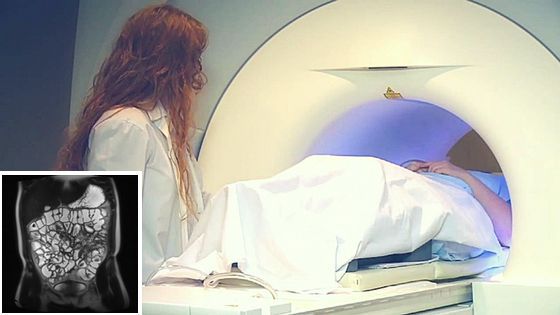 Магнитно-резонансная томография кишечника