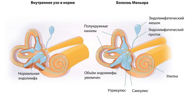 Эндолимфа в структурах внутреннего уха