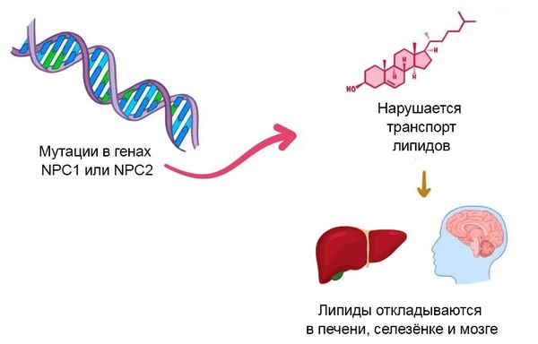 Патогенез болезни Ниманна — Пика