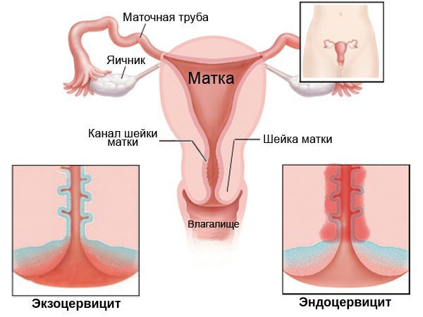 Лейкоциты в мазке у женщин