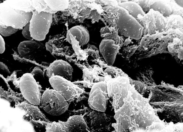 Yersinia pestis, электронная микрофотография