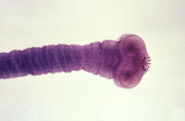 Cвиной цепень [18]