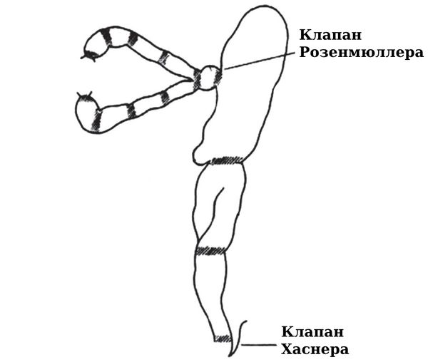 Места непроходимости слёзных путей