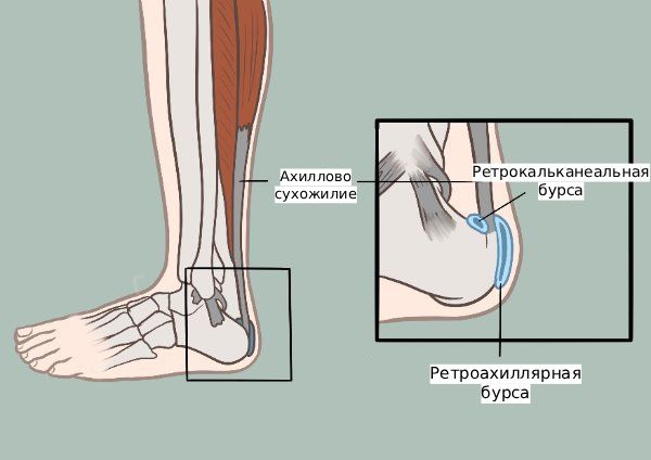 Ретрокальканеальная и ретроахиллярная бурсы