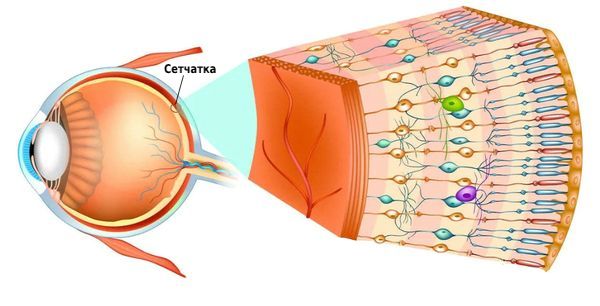 Дистрофия сетчатки глаза: причины, симптомы, лечение