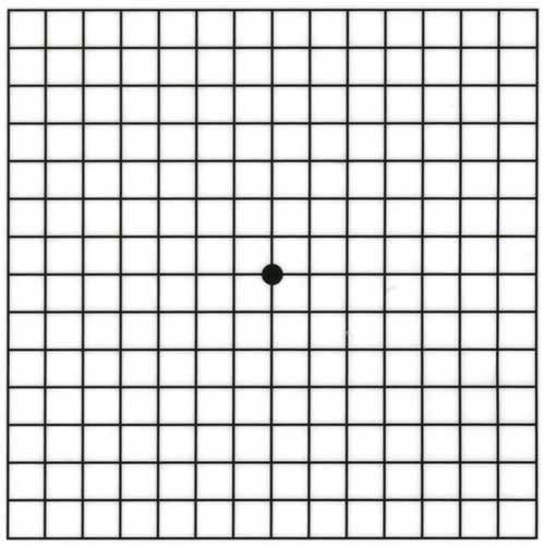 Сетка Амслера Сетка Амслера