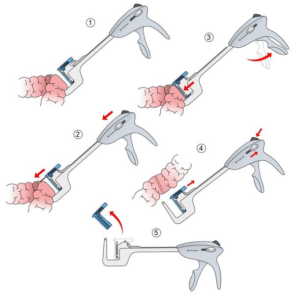 Дикке үйкелу