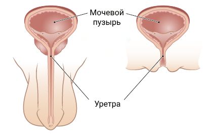 Лечение искривления полового члена в клинике Dekamedical в Москве