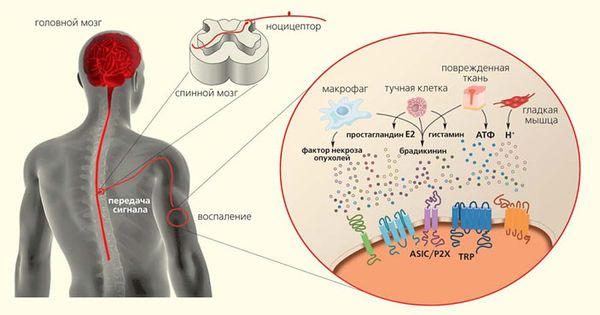 Нейрогенное воспаление