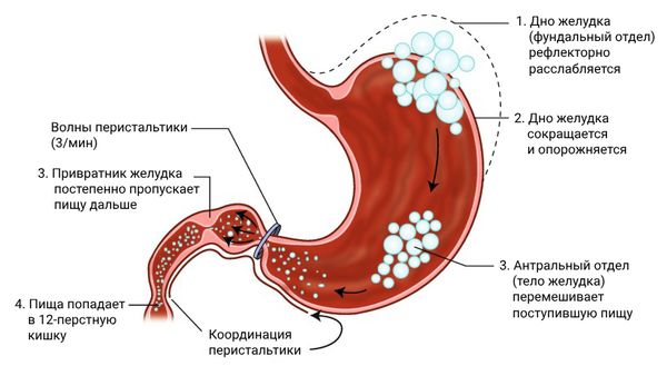 Гастропарез желудка