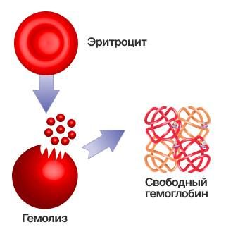 Гемолиз