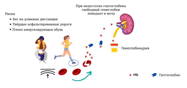 Развитие маршевой гемоглобинурии [14]